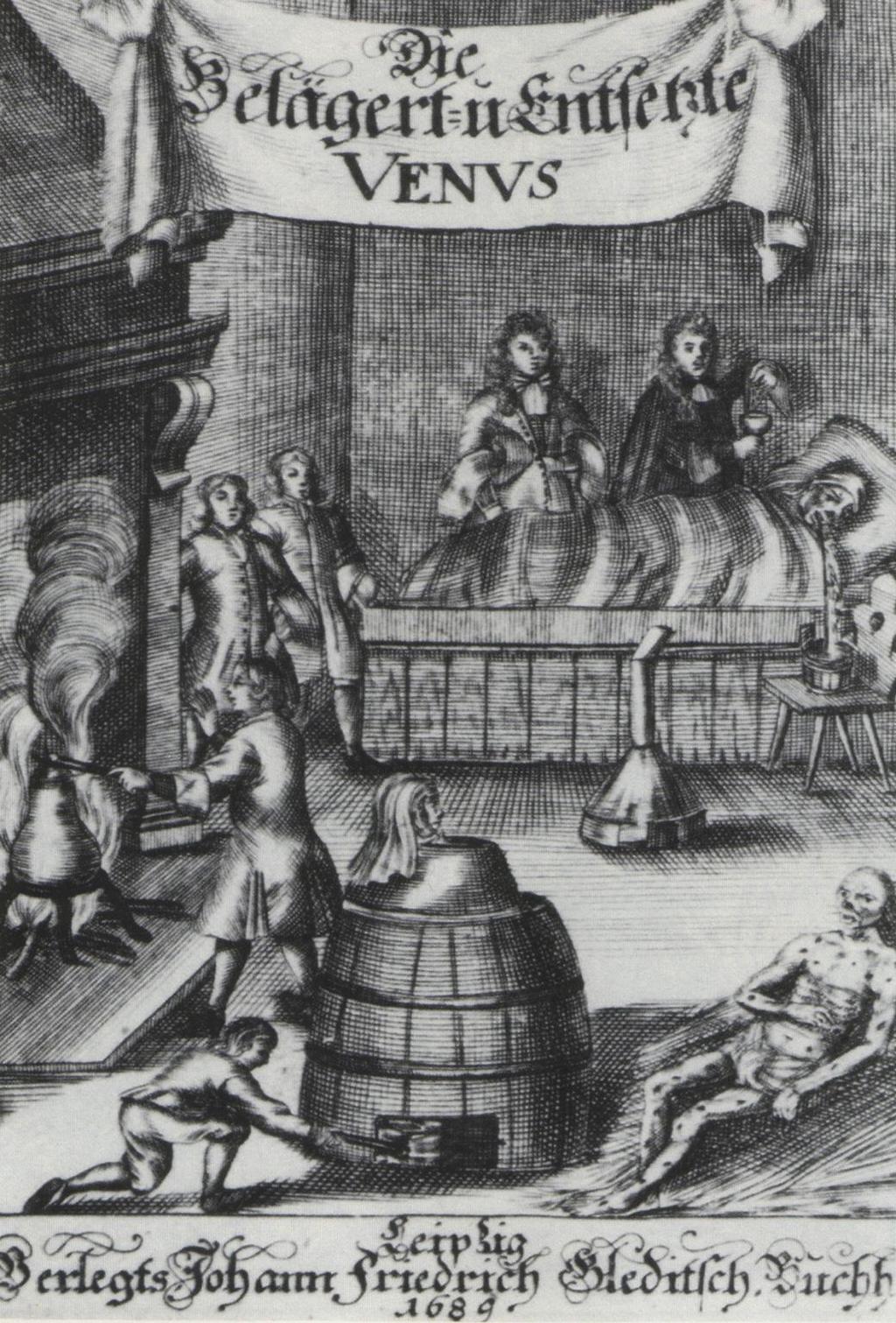 Siglos XVI, XVII y XVIII sudoración (calor), mercurio.