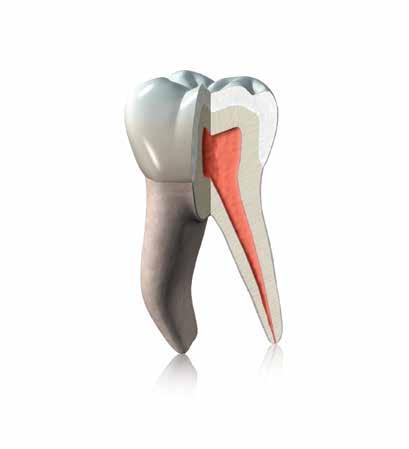 como el diente! El composite de obturación perfecto se caracteriza por una combinación de propiedades físicas parecidas al diente en interacción con gran facilidad de manipulación y estética natural.
