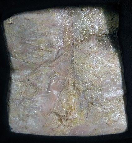 Fig. 12: Abordaje anterior del ganglio celiaco derecho. Plano fascio-muscular Abordaje del Ganglio Celiaco Izquierdo Fig.