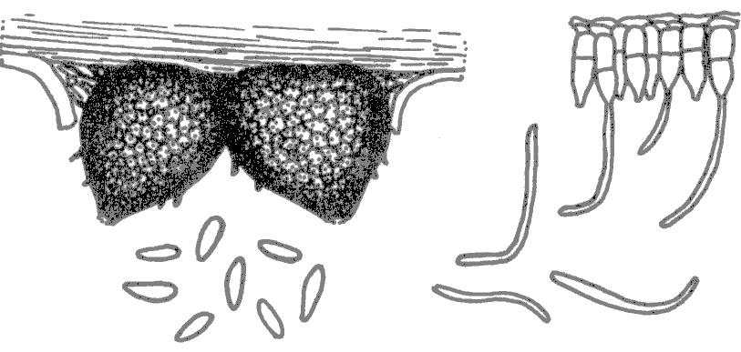 Conidios de dos tipos: cortos y ovoides, largos y curvados Phomopsis sp.