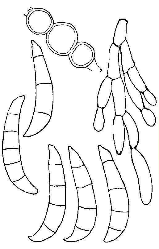 reticulatum 159 (156) Macroconidios anchos o con el lado