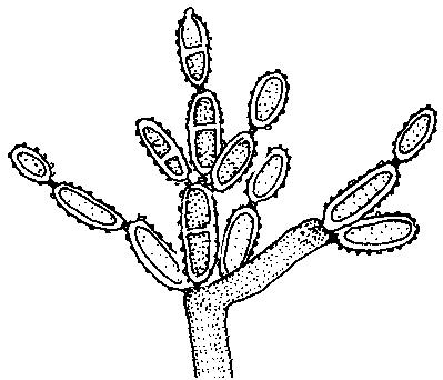 moderado, la mayoría de las esporas esféricas Cladosporium sphaerospermum 170