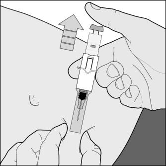 Después de la inyección sujete la jeringa por el capuchón de seguridad de la aguja con los dedos de una mano, agarre con los dedos de la otra mano la zona de sujeción y tire hacia atrás.