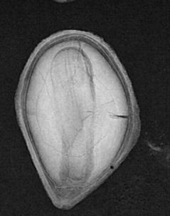 Endospermo con zonas oscuras, opacas vítreas o fisuras Embrión adherido la zona basal del endospermo, sin fisuras o alteraciones, sin embargo el eje cotiledonario es vítreo.
