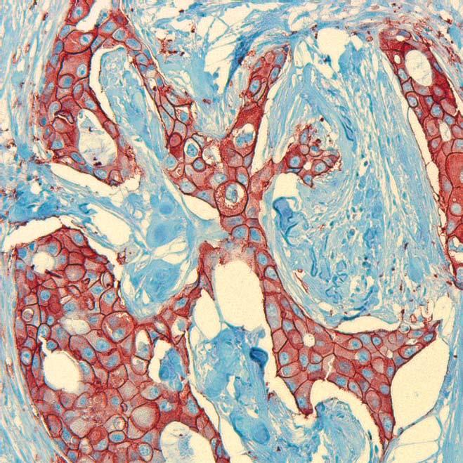 Principales proyectos actuales Estudio del receptor sensor del calcio Tumores del Sistema Nervioso Central Retinoblastoma EN QUÉ CONSISTE?