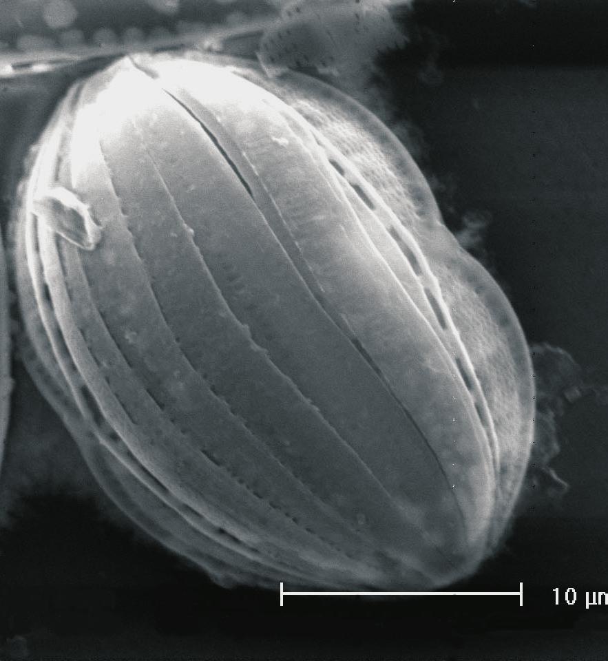 Escala: 10 µm. 6 7 Figuras 6-7. Rhopalodia acuminata.