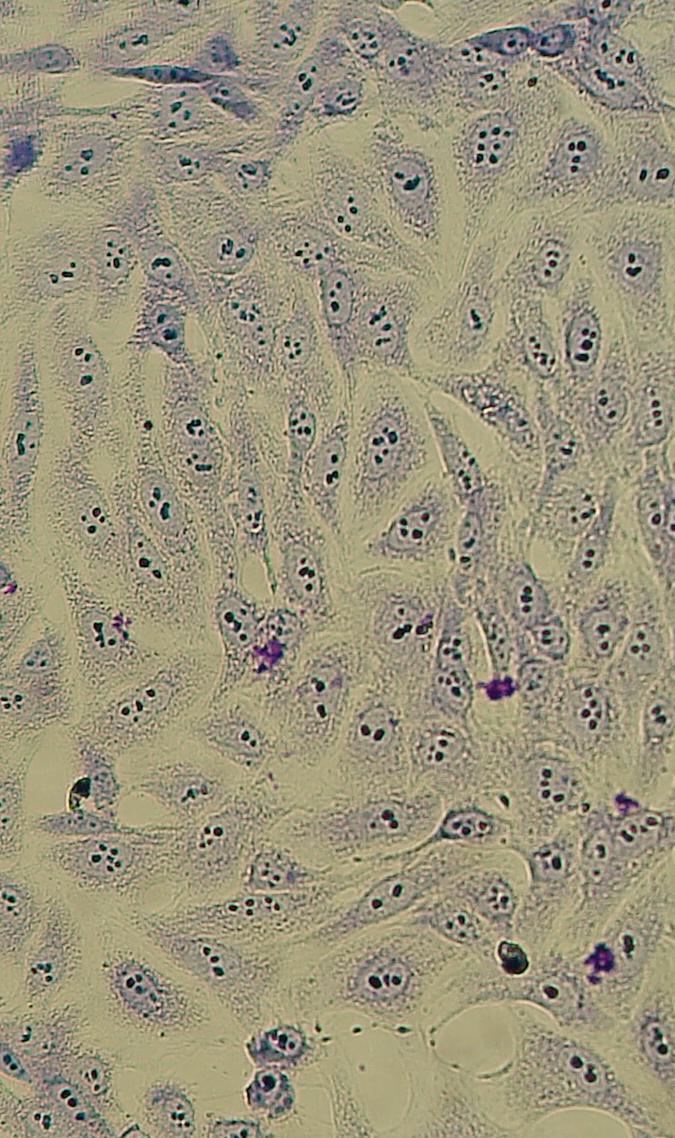 Células GHOST Línea celular continua derivada de un osteosarcoma humano.