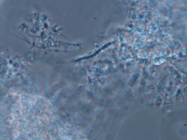 Figura 55: Phyllum Alphaproteobacteria (probe ALF-968 negativo). Figura 56: Phyllum Alphaproteobacteria (probe ALF-968 negativo). Figura 57: Tinción Gram: P. Alpha. (probe ALF-968 negativo). (Gram +).