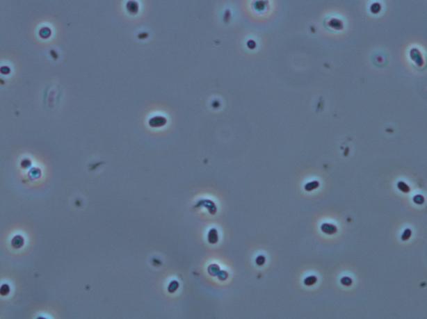 Como ya se ha comentado, se determina un crecimiento filamentoso medio que por lo general, está asociado principalmente a los flóculos, sin embargo, entre los diferentes morfotipos filamentosos