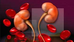 Causas de hematurias no glomerulares 1) Tracto urinario: