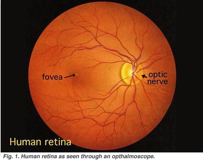 La retina... Papila : el área de forma circular u oval que mide aproximadamente 2 x 1.5 mm. Corresponde al Nervio Óptico.