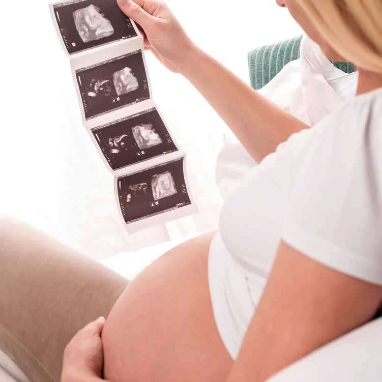 ADOPCIÓN DE EMBRIONES La adopción de embriones consiste en la transferencia de embriones, sobrantes de un tratamiento