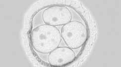 Por lo tanto los embriones son examinados para determinar si también poseen la misma alteración en sus genes y en consecuencia se selecciona el embrión a