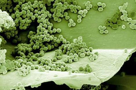 consisten en comunidades de microorganismos embebidos en una matriz de substancias poliméricas extracelulares (EPS), las que les confieren la capacidad única de crecer asociados a superficies.