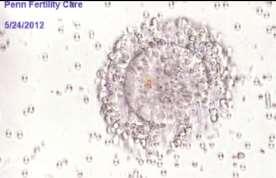 Aislamiento de ovocitos del tejido ovárico para IVM **oocytes isolated in 85%