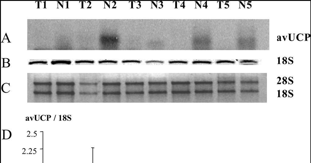NIVEL MOLECULAR : Expresión de la proteína desacoplante mitocondrial (av UCP) del