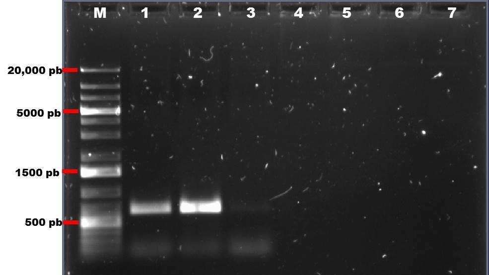 CAPÍTULO III Una vez comprobada la integridad del ADN de los fósmidos, se realizó una amplificación por PCR punto final utilizando los oligonucleótidos degenerados KP y 5LL para validad la presencia
