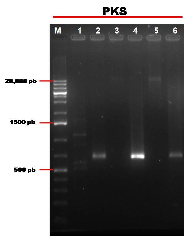 CAPÍTULO III Figura 3.3 Amplificaciones de los genes KS-PKS Tipo I. Despliegue electroforético en gel de agarosa teñido con 1 μg ml -1 de bromuro de etidio. M): escalera de ADN de 1 kb, 1) ADNg de E.