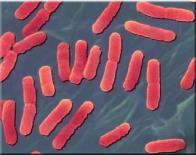 Streptococcus agalactiae Mycoplasma bovis gram positivas Ambientales (infecciones entre los