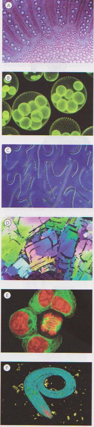 Tipos de microscopios ópticos A) Campo luminoso (Tradicional) B) Campo oscuro (no teñidas) C) Contraste de fases
