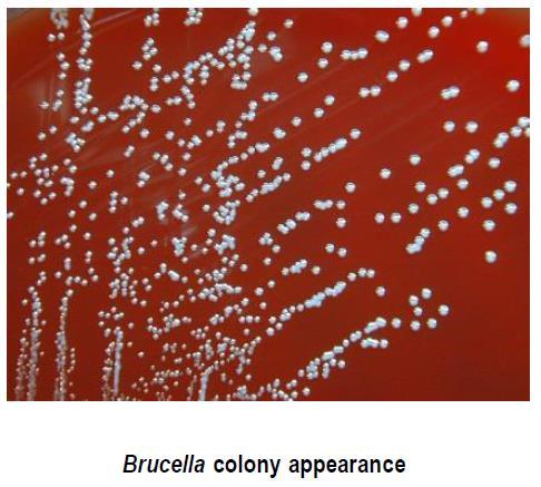 Brucella spp. INFORMACIÓN El género Brucella pertenece a la familia Brucellaceae e incluye diez especies todas cocobacilos gran negativos, pequeñas, inmóviles, no generan esporas, aeróbicos.