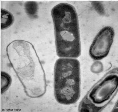 2. a. MICROSCOPIA DE TRANSMISIÓN Microbiología Ambiental 2017 Imagen 6. Bacilos en división. (Ref.