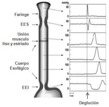 El EEI, tiene una longitud de 2-4 cm y está formado por musculatura lisa, envuelta por el diafragma. Está situado en una zona de alta tensión y es el principal componente de la barrera antirreflujo.