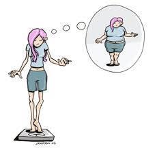 Rechazo a un peso mínimo normal Autoestima depende en gran medida de la imagen corporal Miedo intenso a ganar