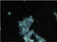 artículostécnicos Figura 1. Imagen en campo oscuro. Figura 2. Imagen con sonda EUBmix. Figura 3. Imagen LIVE/DEAD BacLight Bacterial Viability. flóculo. Esta técnica se utiliza para Figura 4.