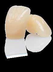 PRÓTESIS REMOVIBLES Cervitec Gel Una higiene oral intensiva con Cervitec Gel mejora los parámetros clínicos de la mucositis periimplantaria.