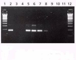 DETECCIÓN POR PCR DE SOJA GENÉTICAMENTE MODIFICADA 1, 12 Marcadores de