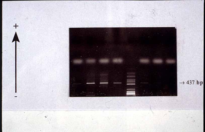 PCR + + + + + - - Presencia de banda -
