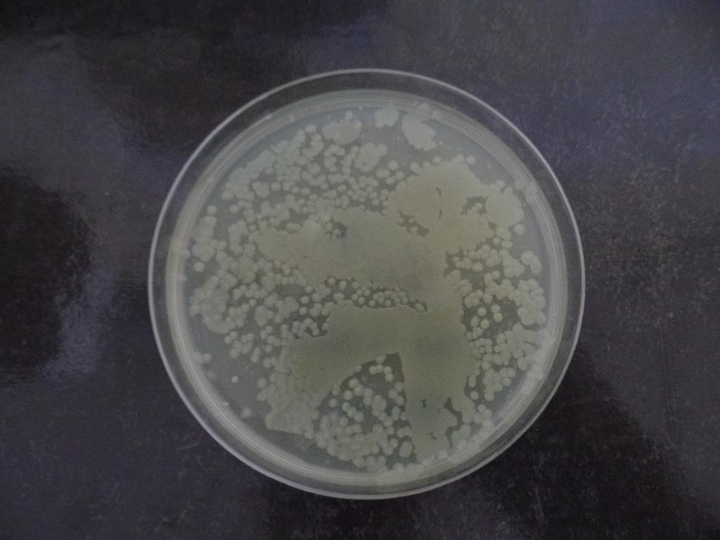 Diferentes determinaciones - La concentración de bacterias totales TSA cultivable, bacterias formadoras de esporas, presumibles Vibrios (TCBS y Chromagar).