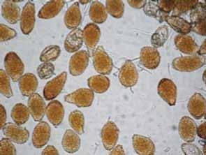 de variedad SP 79-2233, y del clon EC01-744 se observaron síntomas y esporas características de la roya naranja.