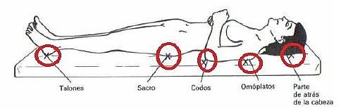 Figura N 02 Decúbito lateral: En la posición de decúbito lateral: orejas, acromion, codos,