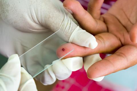 (Tendero, 2018) 1.1.9. Tratamiento (OPS/OMS, 2013) La Cloroquina fue el tratamiento de elección para el paludismo y es aún usado en la mayoría de los países para el tratamiento de P.