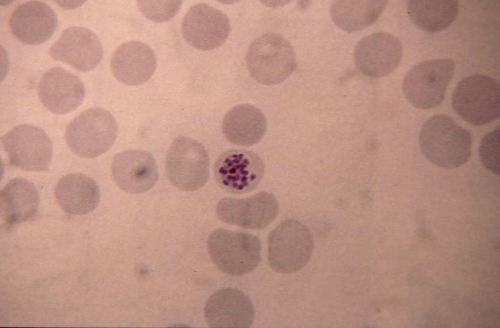encontrados en sangre periférica: Anillos y/o gametocitos Los pre-esquizontes y esquizontes se