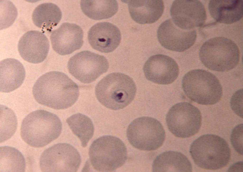 P. malariae Aspecto de los eritrocitos: Tamaño