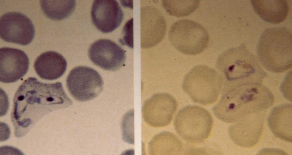 ( + ) Gránulos pequeños, redondos, rosados o rojizos Distribución uniforme en todo el eritrocito Presente en todos los
