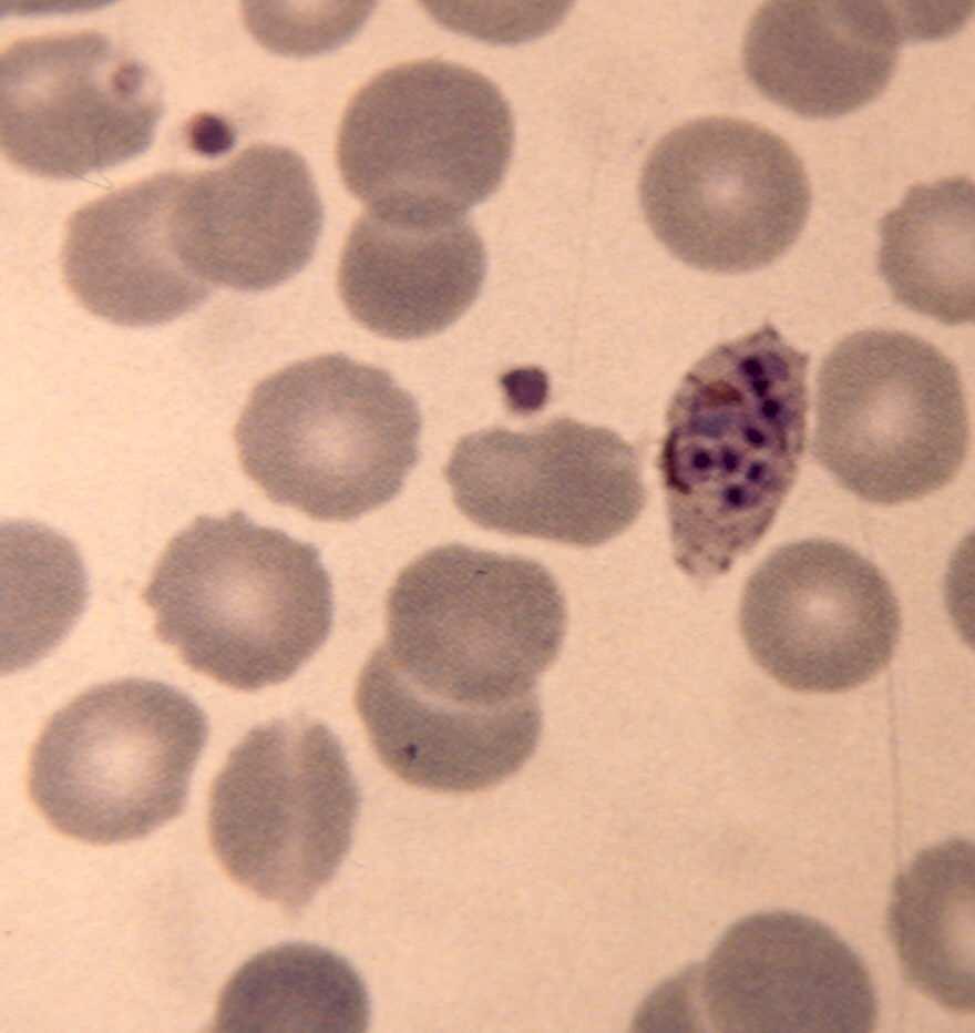 merozoitos (promedio 8) Estadios encontrados en sangre periférica: (Todos los estadios se pueden ver).