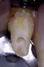 anatomía dental