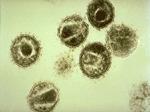 1 PARASITOS UNIVERSALES: LOS VIRUS Los virus se consideran parásitos porque viven a expensas de un organismo al cual deterioran.