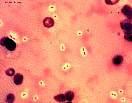 Streptococcus pneumoniae (Neumococo) Habita en el tracto