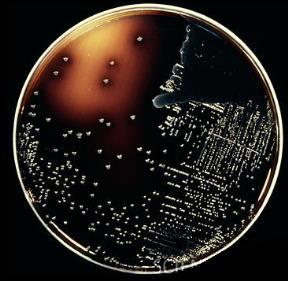 Enterococcus: clasificación Streptococcus