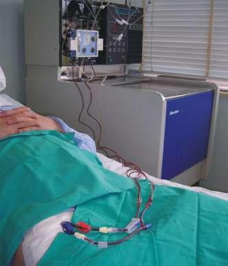 AFERESIS Es un procedimiento indoloro que consiste en conectar por vía venosa al paciente a una