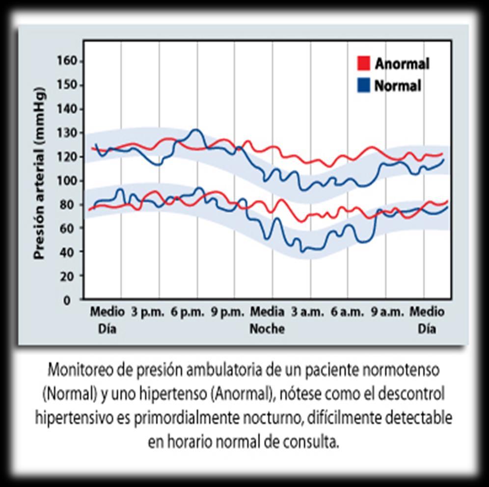 Hipertensión Nocturna La presión arterial fluctua a lo largo del día. Ciclo sincrónico con el sueño.