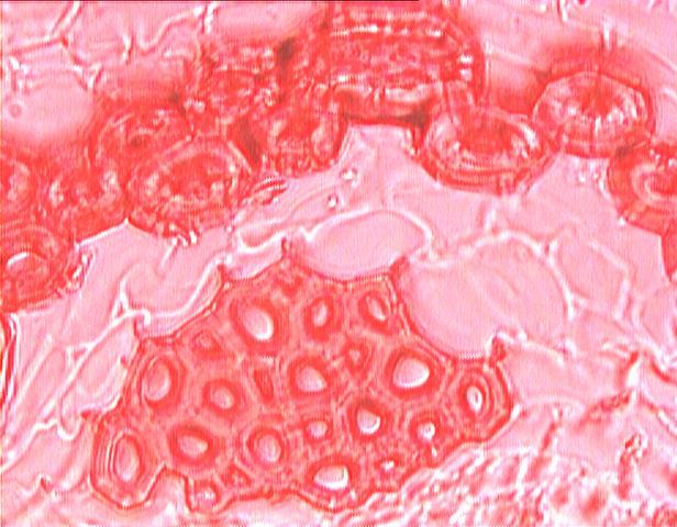 Braquiesclereida (célula