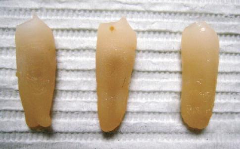 Culminado el paso anterior los dientes son descalcificados y transparentados por técnica de diafanización (Robertson et al., 1980, p.