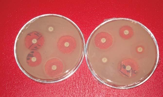 Antimicrobiano Contenido del Staphylococcus E. coli. disco spp.