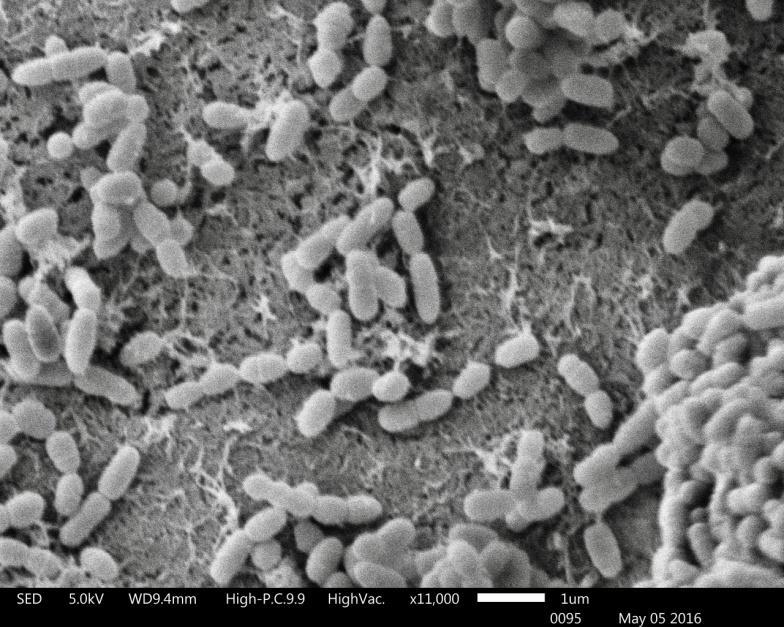 Figura 16. Imagen de microscopía electrónica de barrido de la superficie de un bloque de esmalte (D2) con bacterias de S.mutans (x11000). 7.